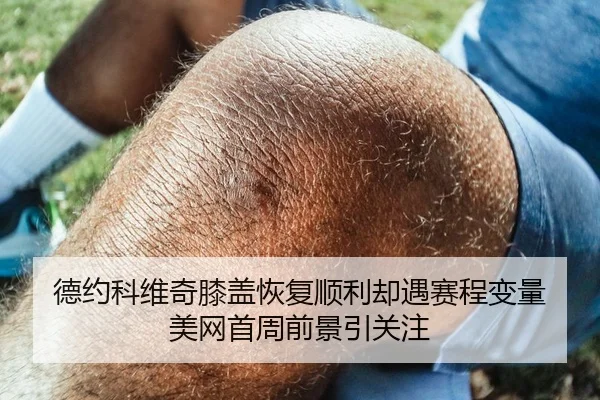 德约科维奇膝盖恢复顺利却遇赛程变量 美网首周前景引关注